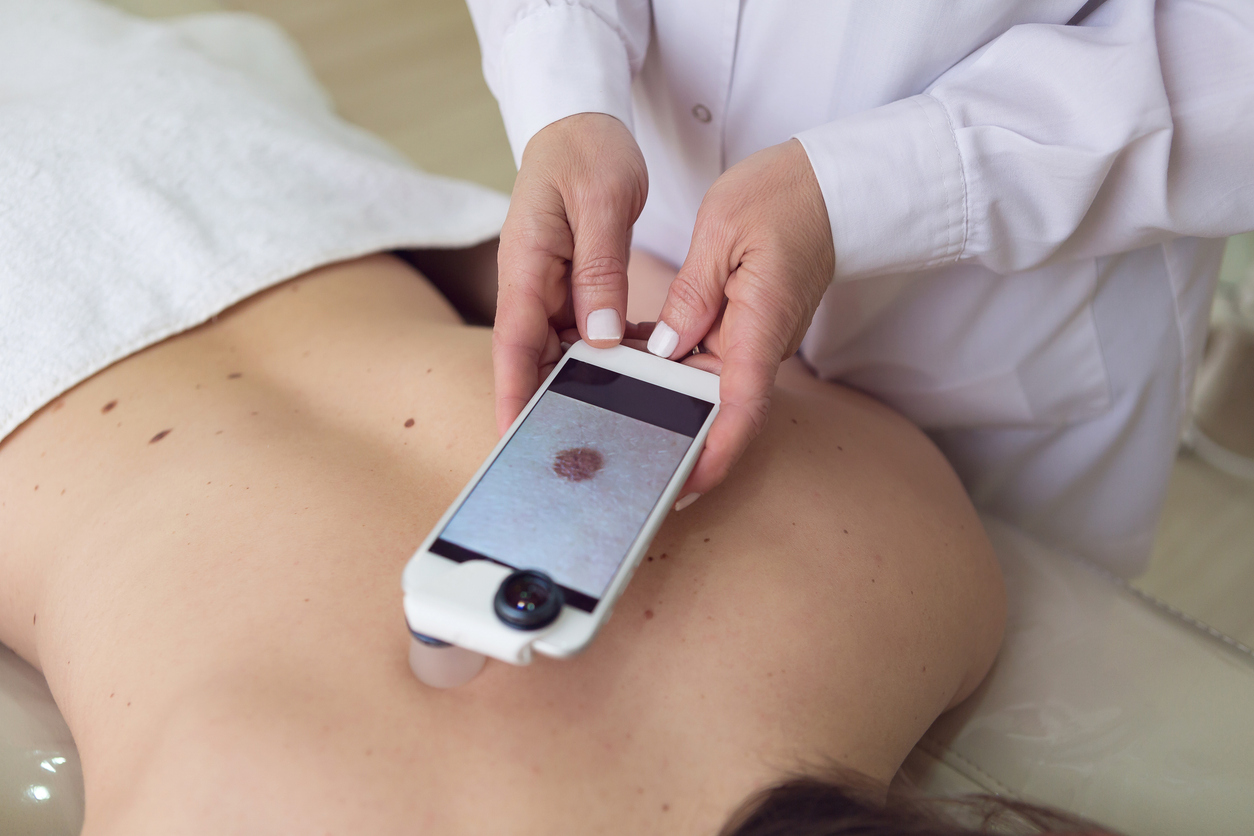 Teledermatologia