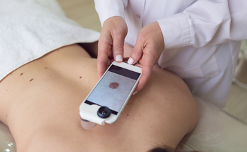 Teledermatologia